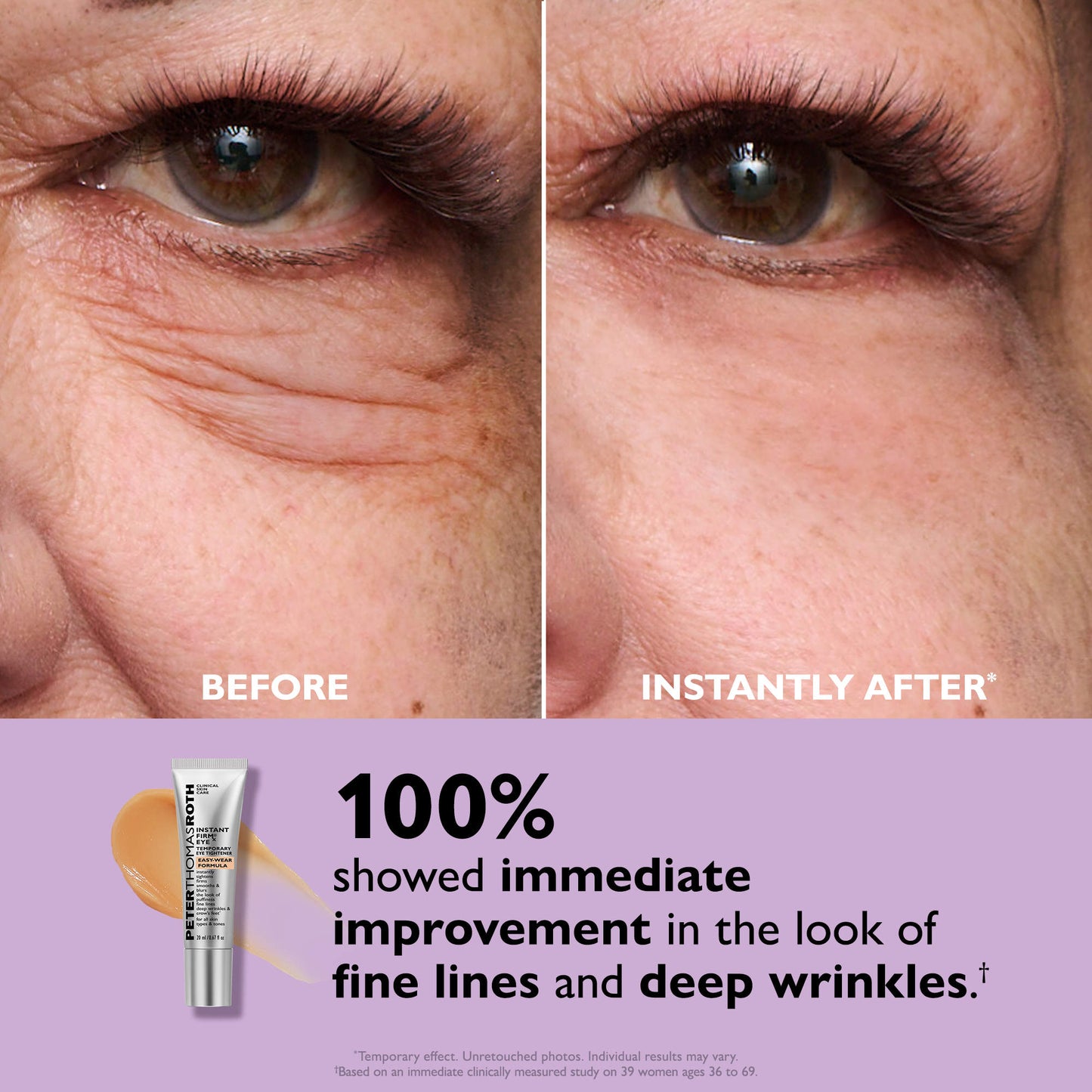 Instant FirmX Eye Cream Tightener™
