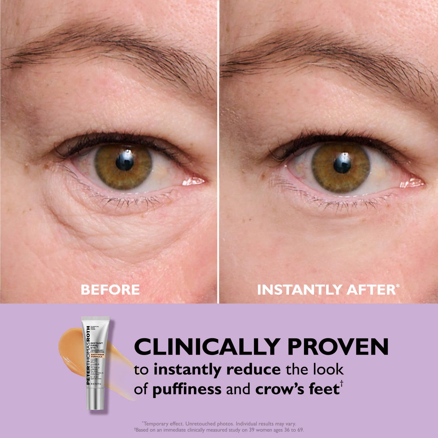 Instant FirmX Eye Cream Tightener™