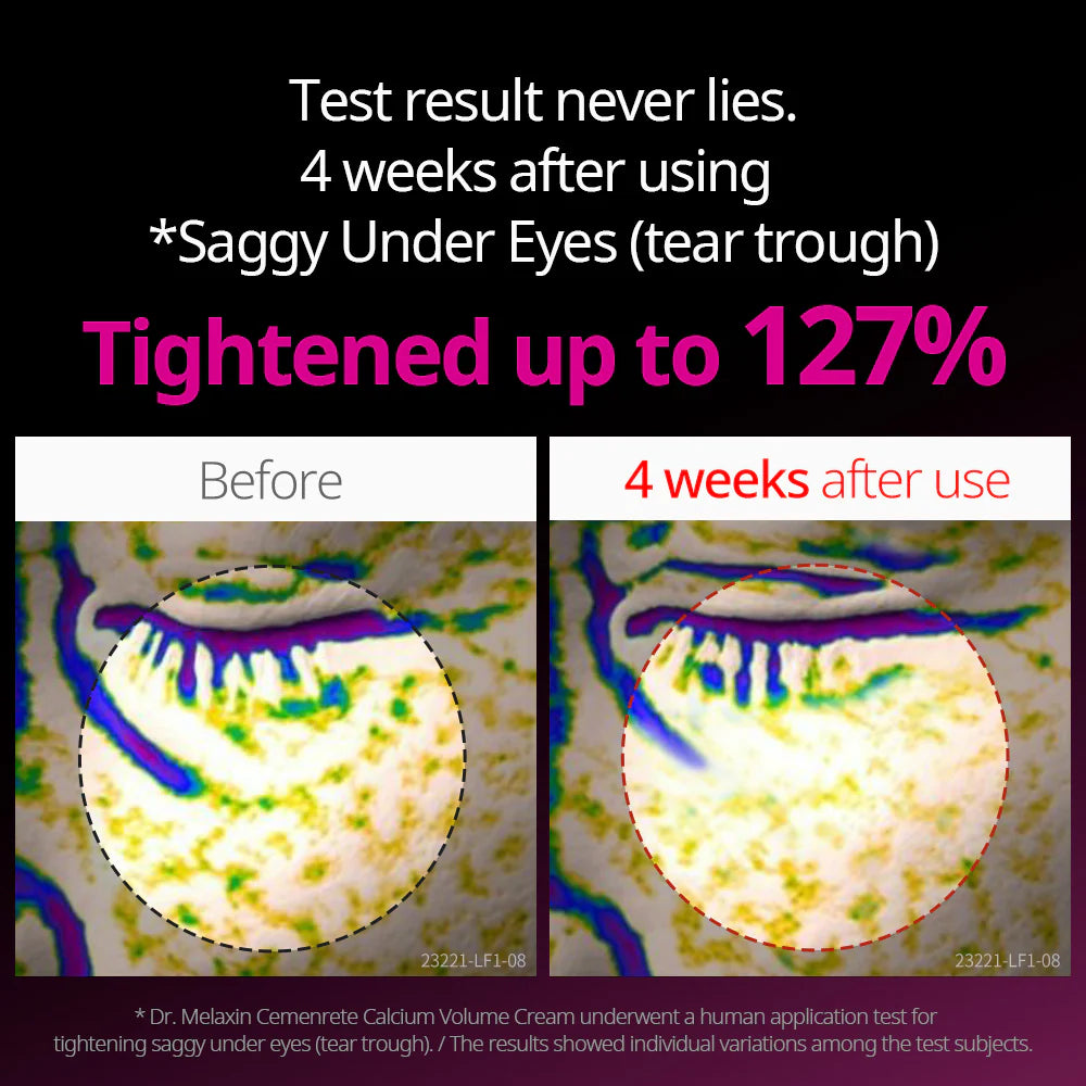 Cemenrete Calcium Cream & Ampoule Duo™