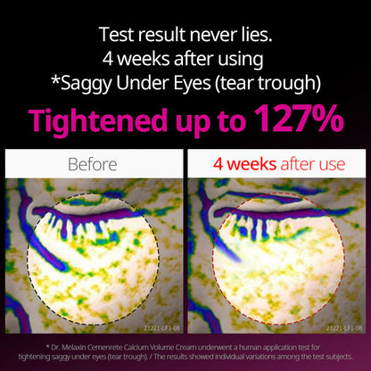 Cemenrete Calcium Cream & Ampoule Duo™