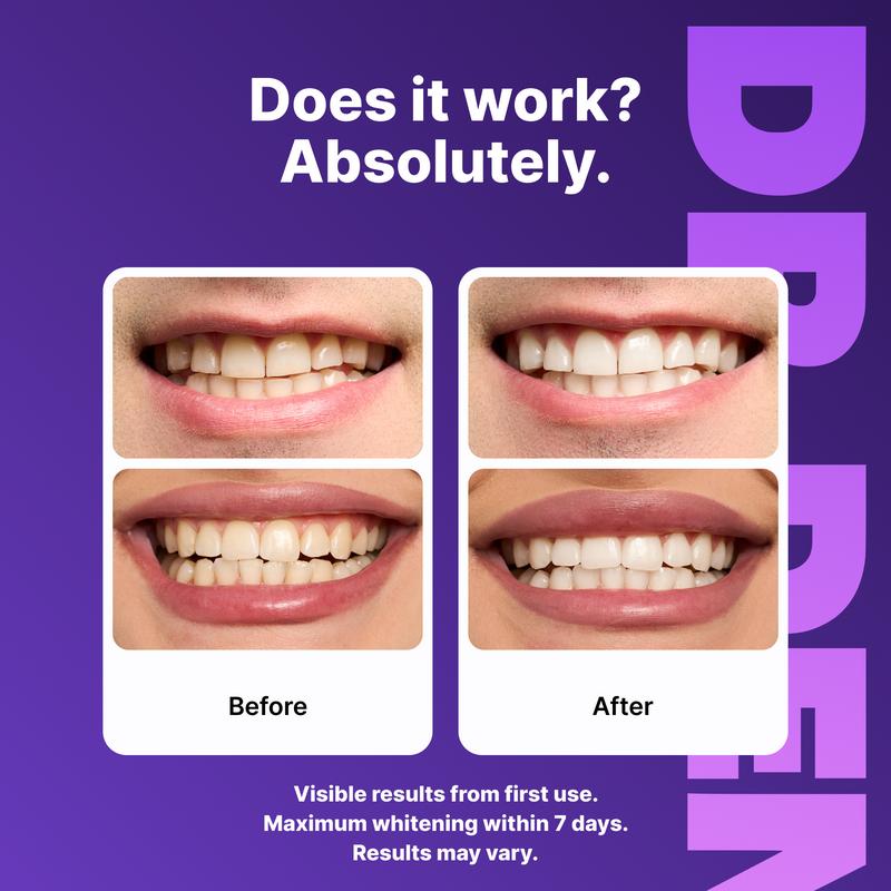 Dr. Dent Purple Teeth Whitening Strips™