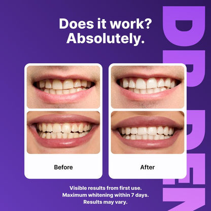 Dr. Dent Purple Teeth Whitening Strips™