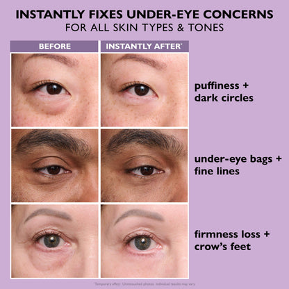 Instant FirmX Eye Cream Tightener™